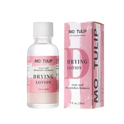 MO TULIP Acne Drying Lotion - Overnight Spot Treatment for Face & Body, 1oz Pimple & Blemish Solution