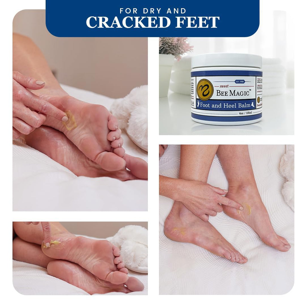 Sweet Bee Naturals Organic Foot Balm - Intensive Heel Cream for Dry, Cracked Feet - 4 OZ Jar