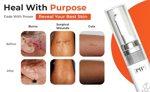 PUREHEALPLUS Silicone Scar Gel for Old & New Scars, Keloids, C-Section, Burns, Acne, Surgical Scar Treatment – Cosmetic Formula with Patented Silicone & Sea Berry Oil, Clinically Tested, Made in USA