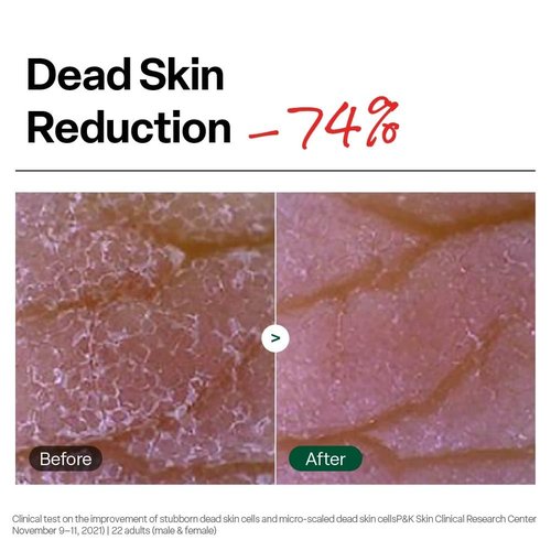 Dr. G Brightening Peeling Gel - Korean Exfoliator for Glowy Skin - Hyaluronic Acid & Vitamin C - 4.23 fl oz