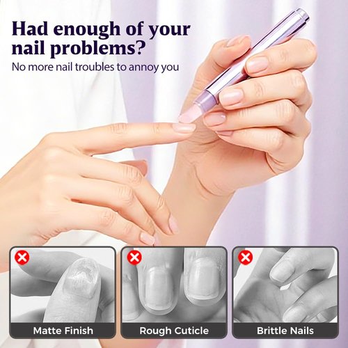 Skiennix 3-in-1 Cuticle Oil Pen - Moisturizing Nail Care Tool with Ceramic Tip for Dry & Damaged Nails (1pc)