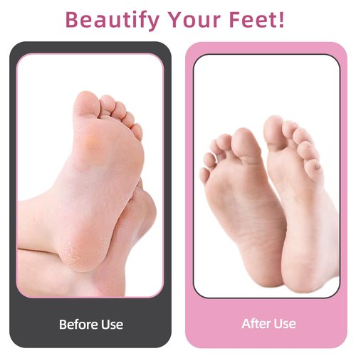 AprElm 4.8IN Longer Electric Foot Callus Remover with 80pcs Sandpaper Discs, Professional Aluminum Callus Remover for Feet, Stepless Speed Control Pedicure Tools for Dead Skin (Pink)