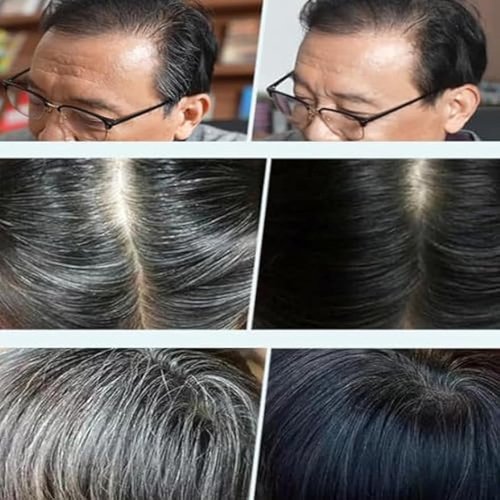 Skiennix Black Fruit Hair Dye Cream - Natural Grey Coverage for Men & Women | Dark Brown Shade