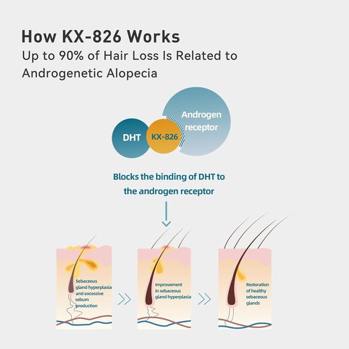 KINTOR Hair Regrowth Spray 0.9% KX-826 - Supports Healthy Hair Growth & Oil Control | 60ml