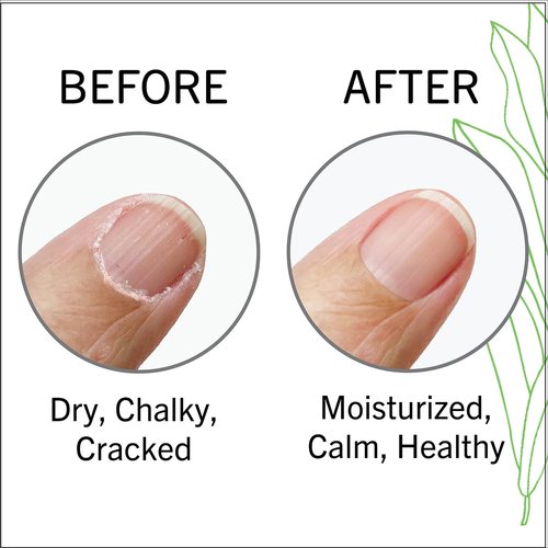 Super Smooth Cuticle Oil for Nails – Cuticle Moisturizer, Nail Strengthener & Nail Growth Oil with Pomegranate Oil & Argan Oil – Unscented – 3 ml