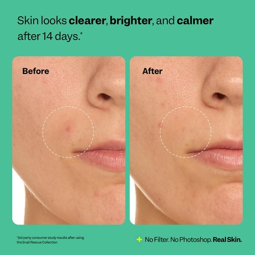 Peach Slices - Snail Rescue Purifying Cleanser (4.05 oz) - Snail Mucin Concentrate - Cleanse & Refresh Skin - Pine Bark, Hyaluronic Acid & Cica - Vegan & Cruelty Free - Korean Skin Care & Beauty