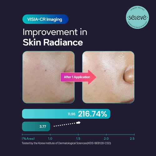 SELEVE Glow Caviar Bubble Toner – Hydrating & Glow Face Toner with Green Caviar Liposomal, Niacinamide, Panthenol & Ferulic Acid, Sensitive & Dry Skin, Korean Skin Care (3.38 fl.oz / 100ml)