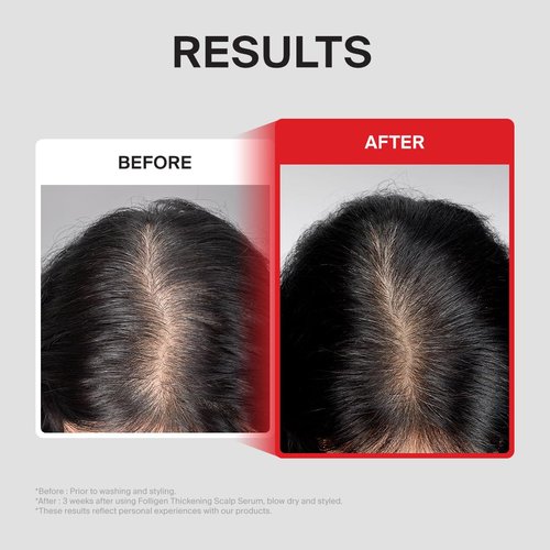 Dr.FORHAIR Folligen Thickening Scalp Serum - Biotin Density Treatment for Thicker, Fuller Hair | 1.7 oz | Korean Haircare