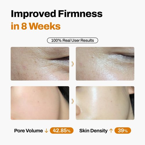 DermiShuttle Anti-Aging Lifting Kit - Firming Face Serum with Collagen & Peptides | 8-Week Hydration