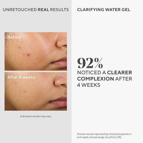 Murad Clarifying Water Gel - Lightweight Moisturizer for Acne-Prone Skin with Salicylic & Hyaluronic Acid - 2 Fl Oz