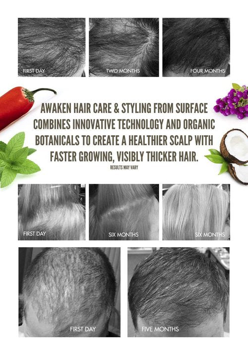 Surface Hair - Awaken Therapeutic Shampoo | Natural Formula for Thinning Hair & Healthy Scalp