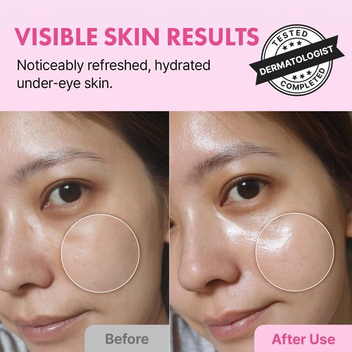 Hanskin Hyaluron Eye Serum - Hydrating Korean Eye Care with 4 Types of Hyaluronic Acid | De-Puffing & Brightening | 0.85 fl oz