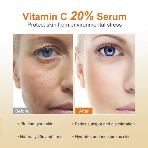 Skiennix Vitamin C Serum 20% - Anti-Aging Face Serum for Radiant Skin & Reduced Fine Lines