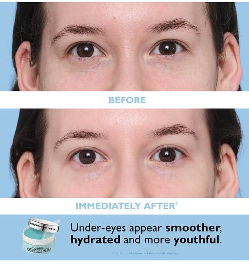 Peter Thomas Roth | Travel Pack Eye Patches - Hydrating & Revitalizing Treatment
