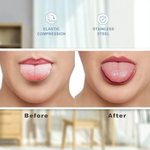 Skiennix Tongue Scraper - 100% Surgical 304 Stainless Steel Cleaner for Fresh Breath | 2 Pack