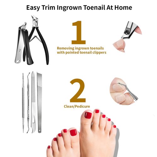 EBEWANLI Ingrown Toenail Removal Kit, 6PCS Stainless Steel Toe Nail Kit, Straight Edge Oblique and Curved Slanted Nail Clippers Cutters for Ingrown Nails, Professional Pedicure Tool at Home