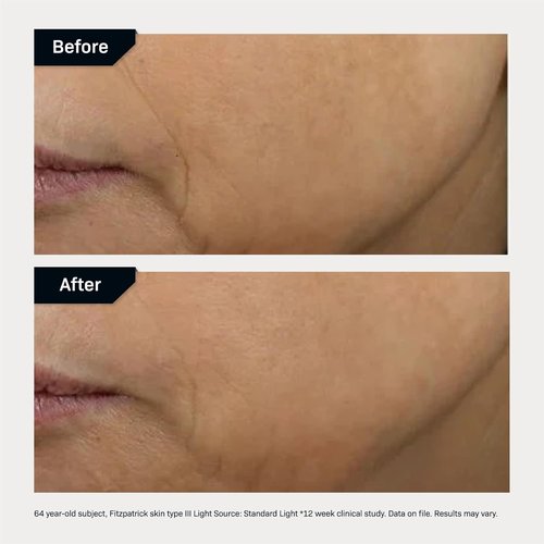 Revision Skincare D·E·J Face Cream® - Advanced Anti-Aging Moisturizer for Lifting & Firming, Antioxidant Rich