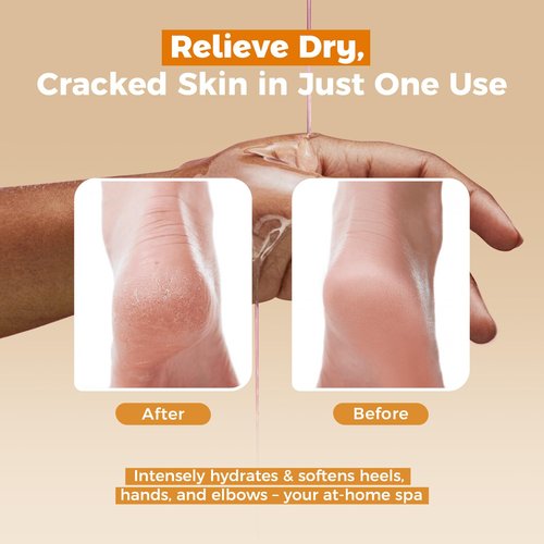 GIRLEARLE Paraffin Wax Refills 10 Packs Unscented for Paraffin Wax Bath Machine - for Dry Cracked Skin on Hands, Feet, Elbows - Moisturizing Hydration to Relieve Stiff Muscles & Joints