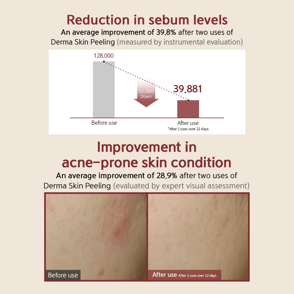 [BQCELL] [Made In Korea] [DERMA SKIN PEELING 2g / Recell Cure Serum 2ml, Safety Cap 1ea, 3set], Acne Skin Available, Exfoliating, Facial Scrub, Korean Beauty, Blackhead Remover