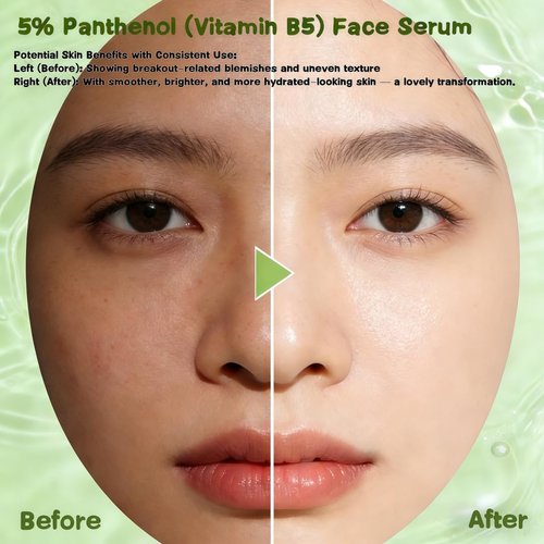 5% Panthenol (Vitamin B5) Face Serum | Sensitive Skin Barrier Support, Hydrating Soothing Serum for Dry Skin, Strengthen Skin Barrier & Soothe Redness, Fragrance-Free for Delicate & Acne-Prone Skin