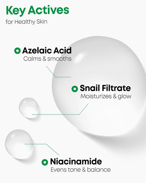 Nineless A-Control Azelaic Acid Toner with AHA & BHA - Pore Refining & Soothing Facial Toner for Acne-Prone Skin - Redness Relief & Dark Spot Corrector, Korean Skincare, 5.07 fl.oz