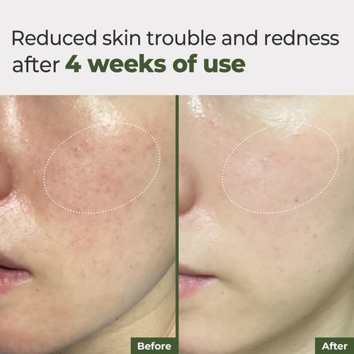 Rbfy. Daily Ampoule Pad (100 Pads) – Korean Vegan Toner Pads for Soothing, Calming & Deep Hydration | for Dry, Stressed, and Sensitive Skin | Centella Asiatica & Panthenol | Korean Skincare