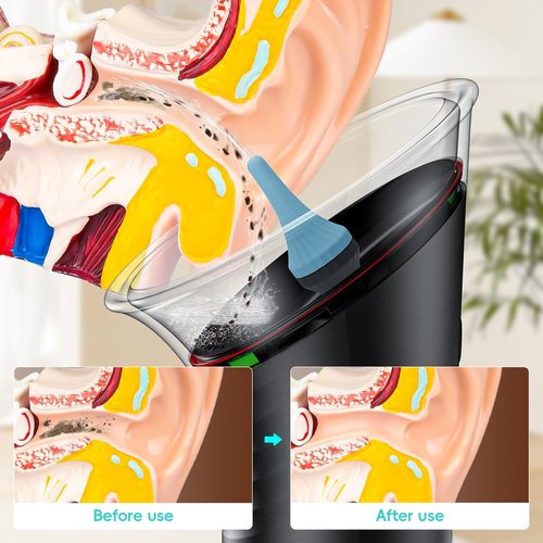 Ear Wax Removal with LED Display, Temodu Electric Ear Cleaner, Rechargeable Earwax Remove Removal Ear Irrigation System, 3 Pressure Modes Ear Cleaning Earwax Removal (12 Disposable Tips)
