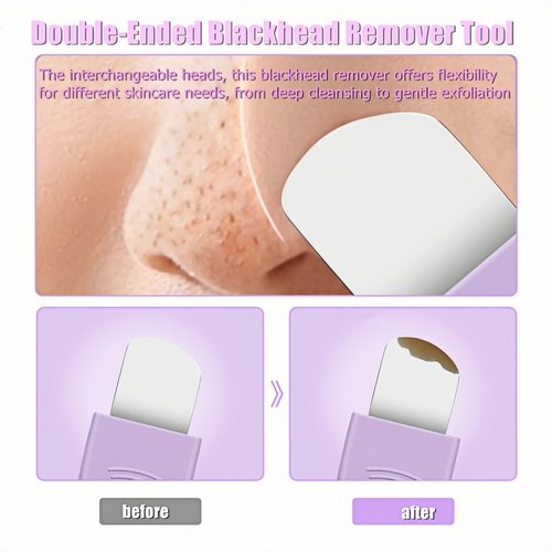 Blackhead Remover & Pimple Extractor Kit Dual-Ended Skin-Friendly Design for Sensitive Skin Professional Pore Cleanse & Acne Home Facial Care Tools with Stainless Steel Scraper (Purple-with Needle)