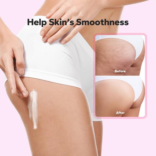 SilkyShark Bum Bum Cream (150ml / 5.07 fl oz), Moisturizing Body Cream with Collagen, Caffeine & Botanical Extracts, Bumbum Cream for Smoother-Looking Skin & All Skin Types