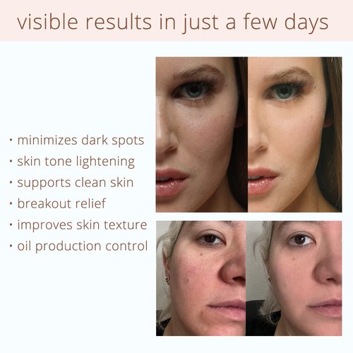 Coffeeface Anti-Aging Moisture Pads - 3-in-1 Exfoliating & Hydrating Skin Treatment | 8 Count | Hypoallergenic