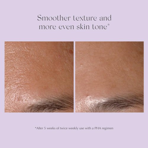 Exuviance Performance Peel AP25 - At-Home Chemical Peel with Glycolic Acid | Anti-Aging Treatment for Fine Lines & Uneven Texture