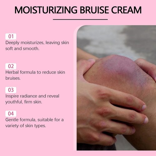 Bruise Cream – Moisturizing & Firming Formula for Arms – 4.23 oz, Legs & Hands – Restores Fragile Skin with Anti-Wrinkle Benefits