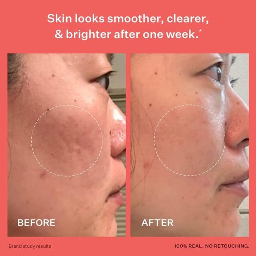 Peach & Lily - Glass Skin Refining Serum for Face - Hydrating Hyaluronic Acid & Niacinamide - 1.35 oz - Vegan, Cruelty-Free Korean Beauty