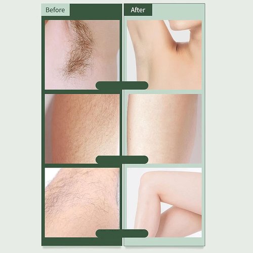 Skiennix Bikini Trimmer - Portable Electric Shaver with LED Light for Gentle Grooming | Dry Use