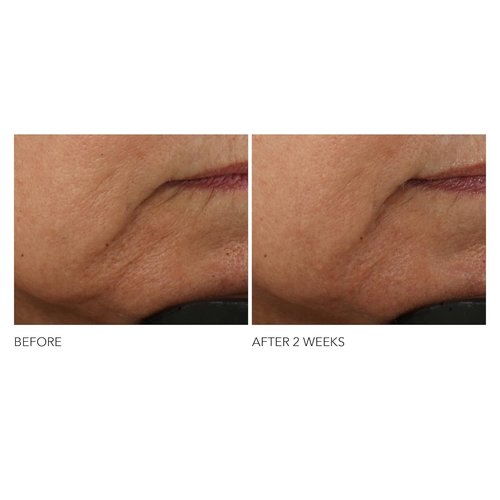 Dr. Dennis Gross Advanced Retinol + Ferulic Intense Wrinkle Cream - Hydrating Formula for Skin Transformation | 2 oz