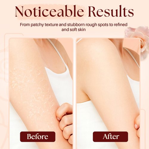 MYSTÉRE BEAUTÉ Himalayan Salt Body Scrub - Exfoliating Collagen & Rose Oil Formula (12 oz) | Reduces Cellulite, Acne & Scars