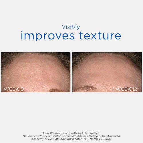 NEOSTRATA Glycolic Chemical Peel - High-Strength Exfoliating Treatment, Fragrance-Free, 2 fl. oz.