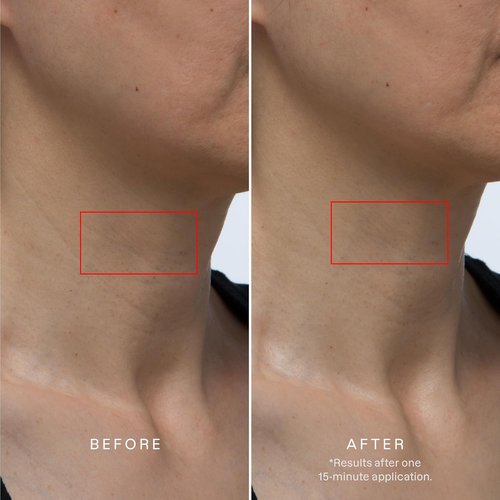 Karuna Collagen Hydrogel Neck & Chest Mask - Firming & Hydrating K-Beauty Treatment | 1-Pack for Wrinkles & Sagging Skin