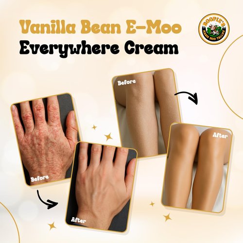 Magic Moo Beef Tallow Vanilla Bean E-Moo Moisturizing Everywhere Suet Tallow Cream with Organic Emu Oil. For Acne, Stretch Marks, Eczema, Hydration, Dry Skin & More! 2oz