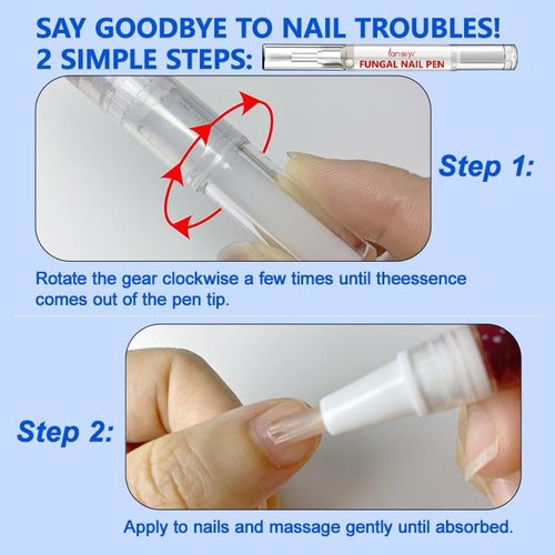 Fungal Nail Pen with Allicin & 25% Undecylenic Acid, Nail Repair Pen | Extra Strength Nail | Toenail & Fingernail Care 2pcs