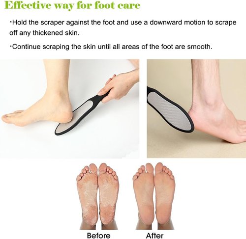 BEZOX Foot File - Double-Sided Callus Remover for Cracked Heels & Corns | Stainless Steel with Storage Bag