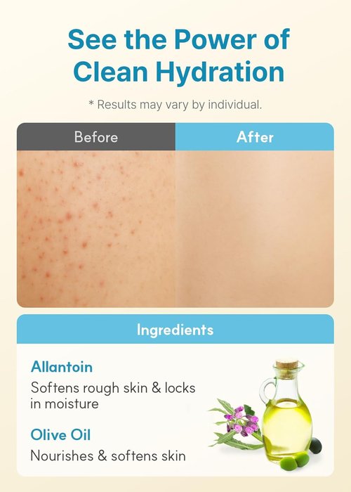 Derma B Daily Moisture Body Lotion - Long-Lasting Cream for Dry & Sensitive Skin | 13.5 fl oz (400ml)