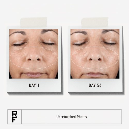 Rodan + Fields Active Hydration Serum - Boost Hydration Levels with Glycerin & Hyaluronic Acid | 1oz