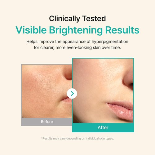 ACWELL Licorice pH Balancing Advanced Facial Serum Ampoule 1.01 fl.oz. - Enhancing Serum for Dull Skin, Reduces Acne and Blemishes, Minimizes Fine Lines, Healthy Glow Skin