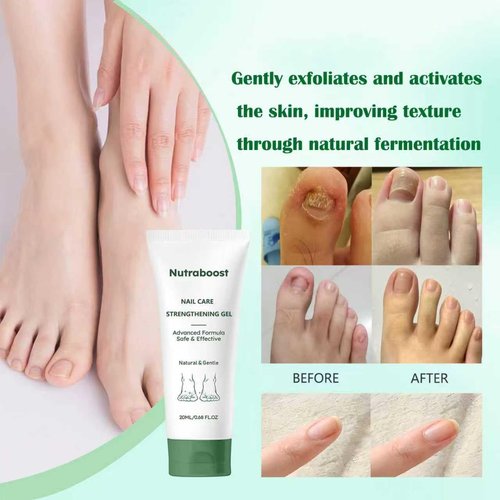 Natural Nail Care Gel, Nutraboost Strengthening Cuticle Serum for Damaged & Brittle Nails, 20ml (1 pcs) (2pcs)