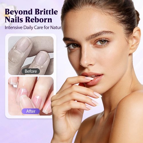 Skiennix 3-in-1 Cuticle Oil Pen - Moisturizing Nail Care Tool with Ceramic Tip for Dry & Damaged Nails (1pc)
