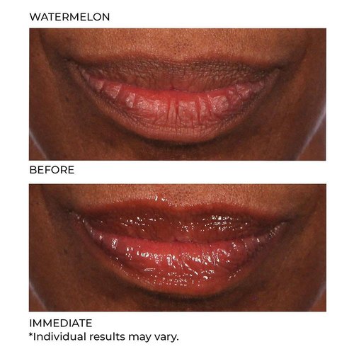 NassifMD Hydro-Screen Lip Plumping Oil - Hydrating Hyaluronic Acid Serum for Soft, Smooth Lips