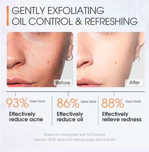 SKINEVER Salicylic Acid Face Exfoliating Scrub - Deep Cleanse & Smooth Skin Texture, 75 ML