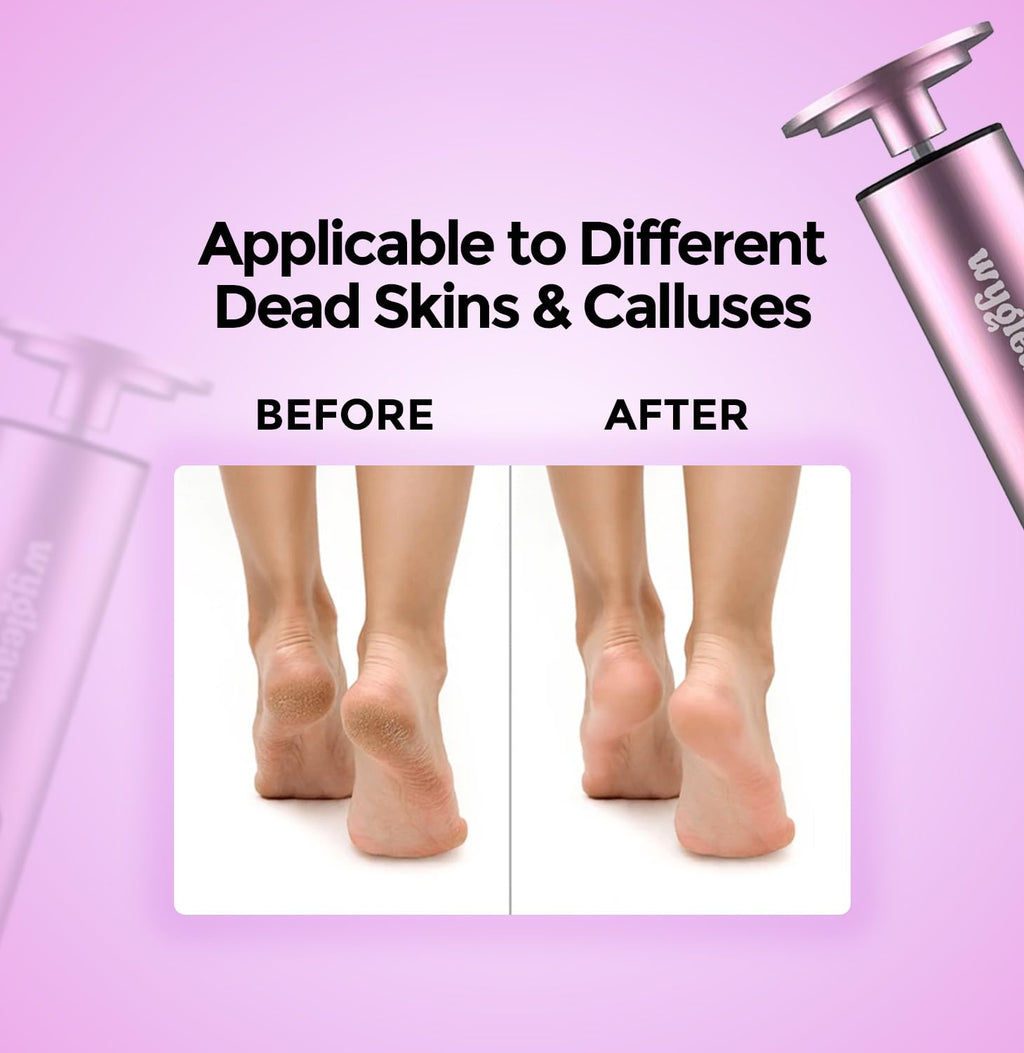 Wygleam Electric Callus Remover for Feet & Nail File Drill Kit - 2 in 1 Rechargeable Pedicure Tools for Flawless Feet - Professional Foot File with 3 Speeds for Dead Skin Removal - At Home Pedicure