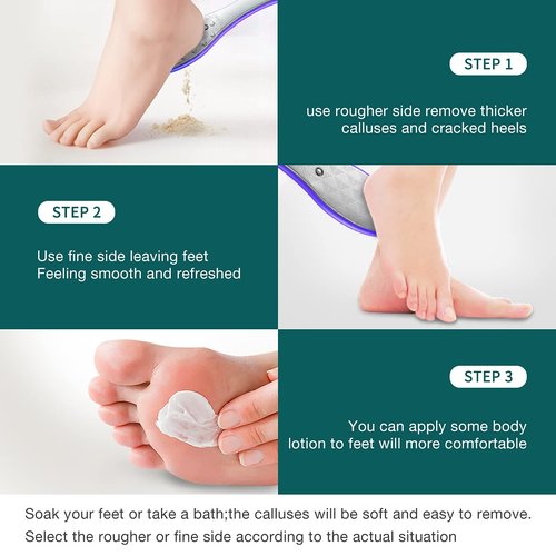 MR.GREEN Foot File Double Sided Pedicure Foot Care Tools Professional Callus Remover Foot Rasp Stainless Steel Foot Scrubber for Feet (Purple)
